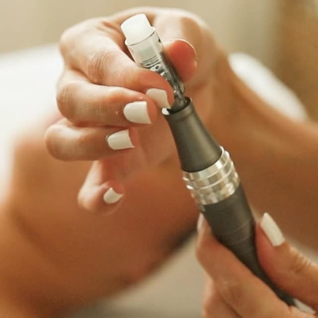 Microneedling Series at Cozy Corner Aesthetics in Rochester, MN